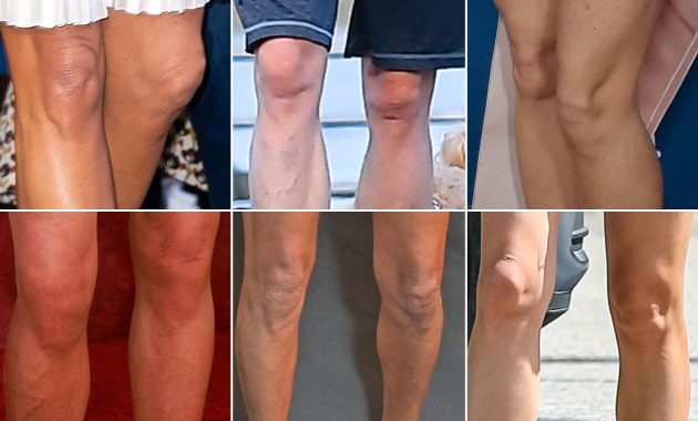 Do Your Knees Reveal Your Age? The Stars Who Hide Their Legs