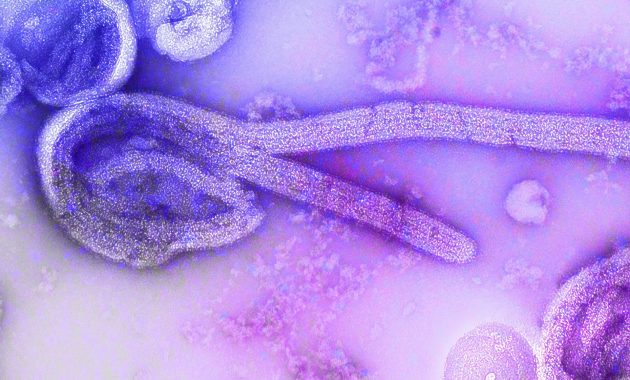 Ebola Outbreak Sparks Fears of Pandemic Trade Restrictions in East Africa
